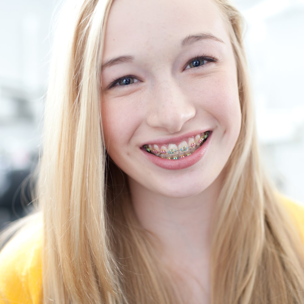 Braces for Teens in Prince George